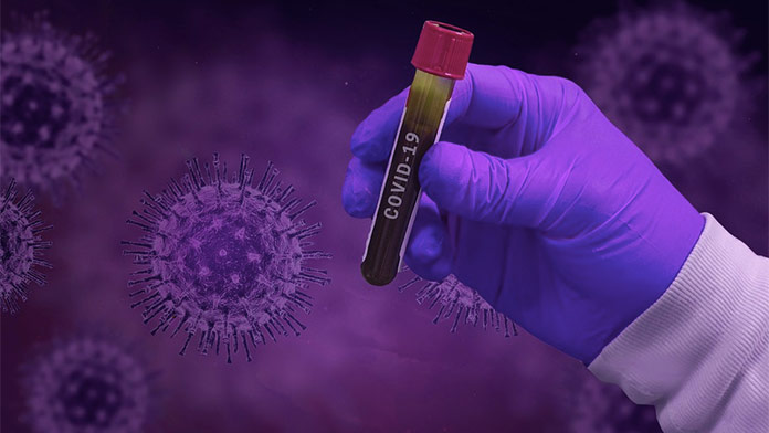 Počet nakazených koronavírusom prekročil vo svete ďalšiu miliónovú hranicu