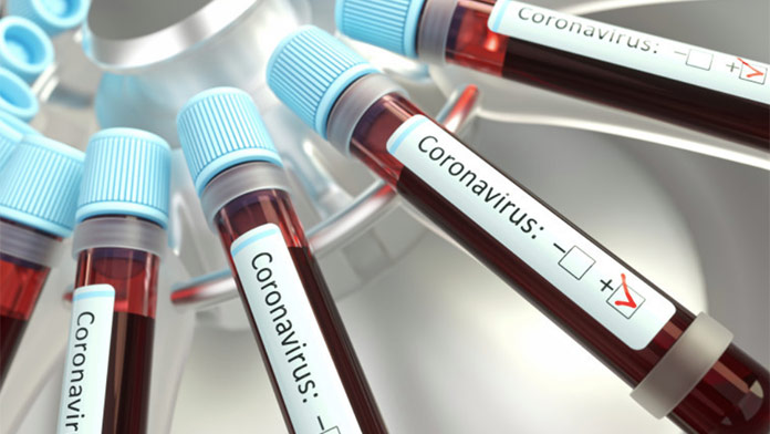 Na Slovensku pribudol opäť vyšší počet pozitívnych prípadov koronavírusu