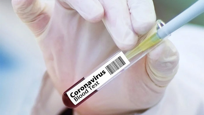 Pribudli ďalší nakazení: Vyliečených z koronavírusu je už 941 ľudí