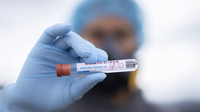 Aktuálne čísla PCR a antigénových testov za pondelok 15. februára